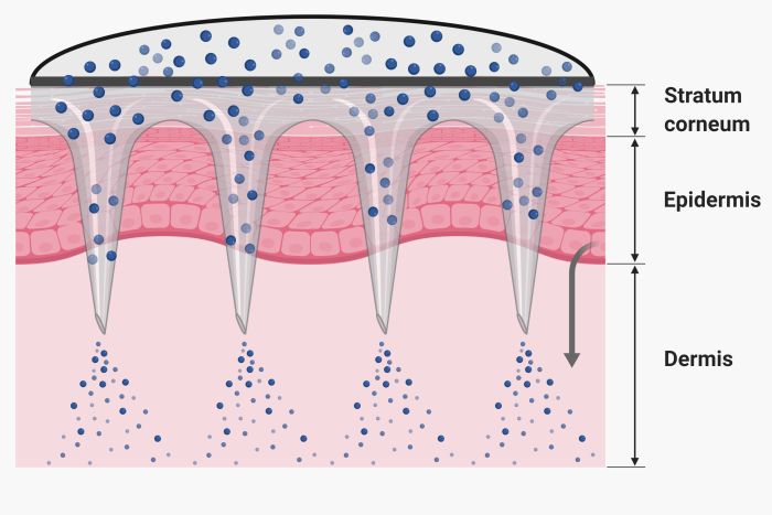 microfluidics microneedle