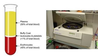 Blood Cell Separation Using Microfluidics-Review - uFluidix