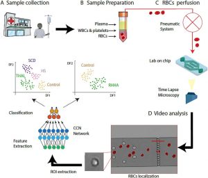 Microfluidic meets deep learning to analyze red blood cells | uFluidix